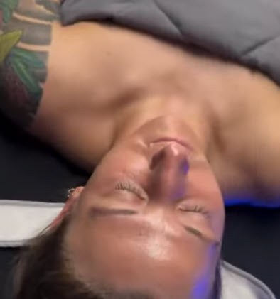 hydrafacials
